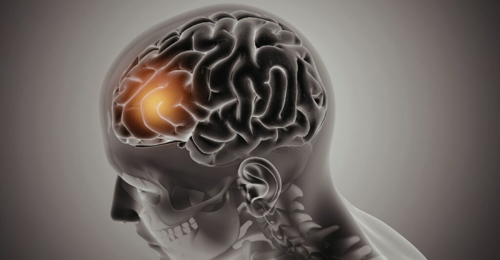 how trauma affects the brain